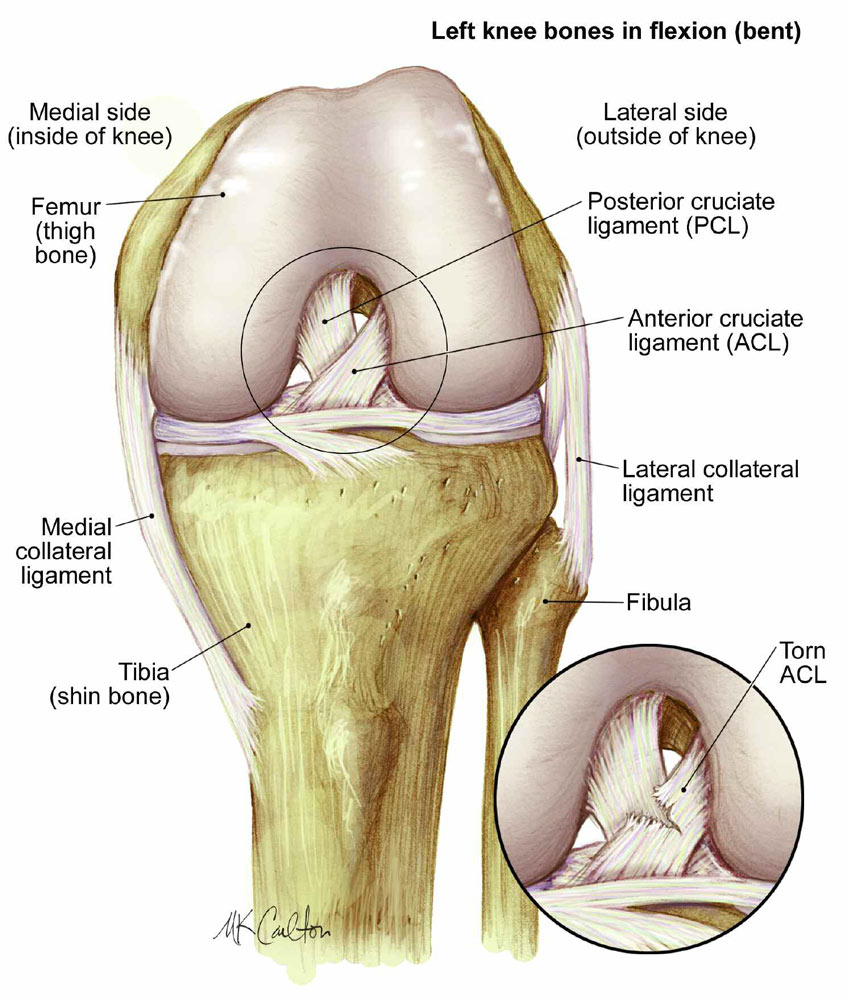 Illustration of the knee joint showing the anterior cruciate ligament (ACL)